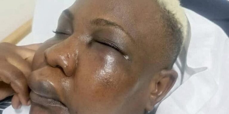 Full Figure accuse Nameere1